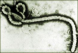 Ebola - mikroskopický snímek